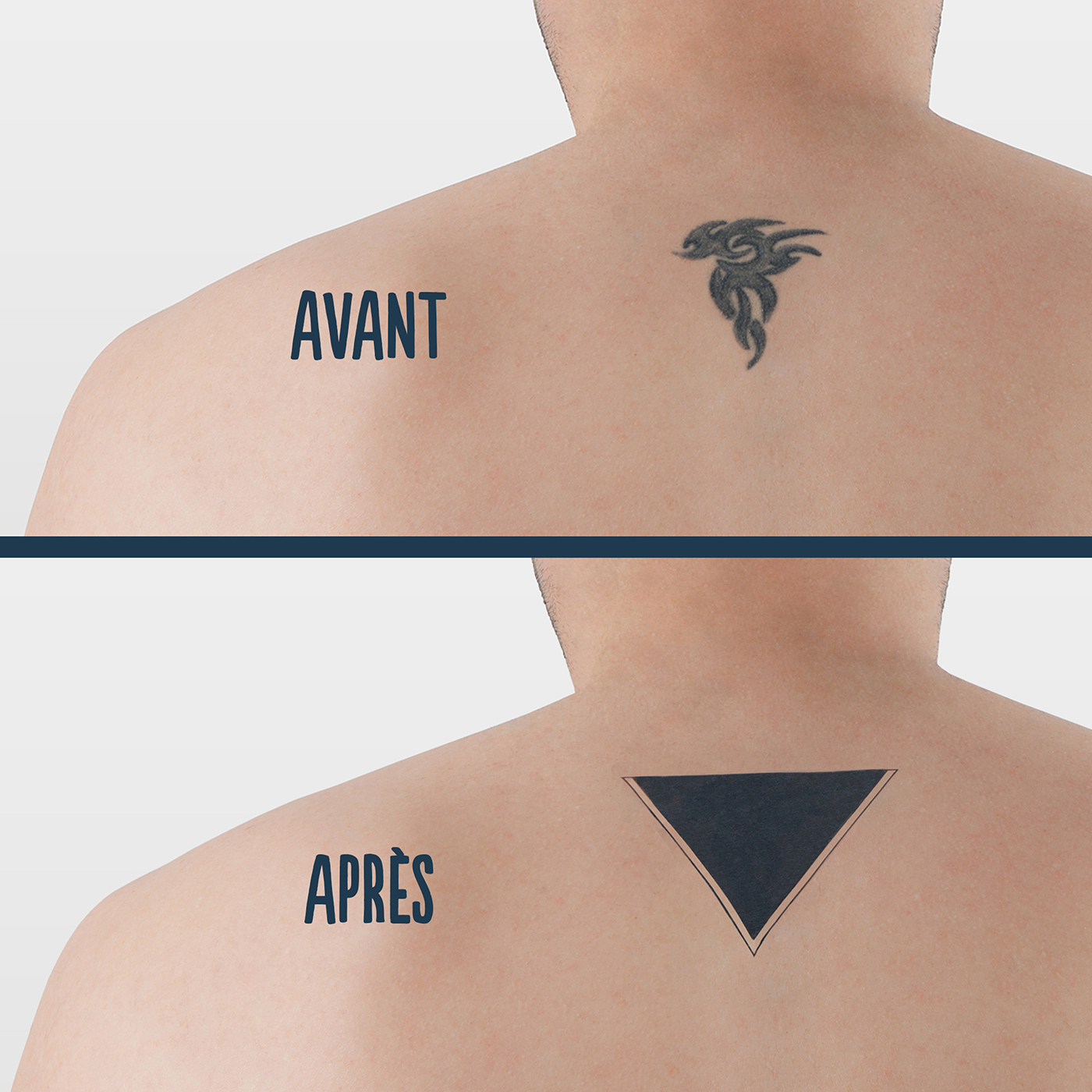 bernard-forever-cachez-ce-tattoo-tatouage-ph-m-re-correcteur image 3